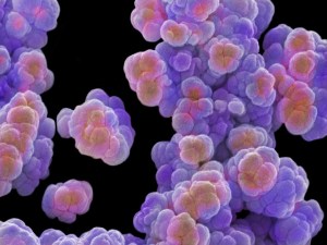 1.14958-C0137190-Archaea_Methanosar