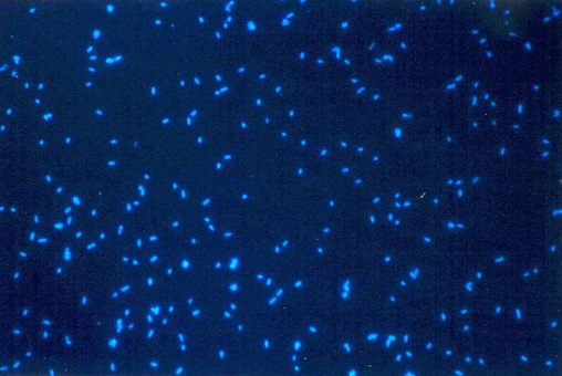 Bacteria in seawater, lit up and viewed with a microscope. Pretty, huh? (icm.csic.es)