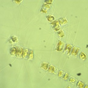 Living with Diatoms, Part II: A Marine Science&nbsp;Podcast!