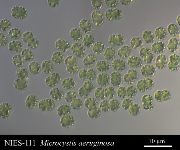 A microscope image of Microcystis aeruginosa, collected from a eutrophic lake in Japan. Image from http://www.shigen.nig.ac.jp/algae/strainDetailAction.do?stockNo=NIES-111. 